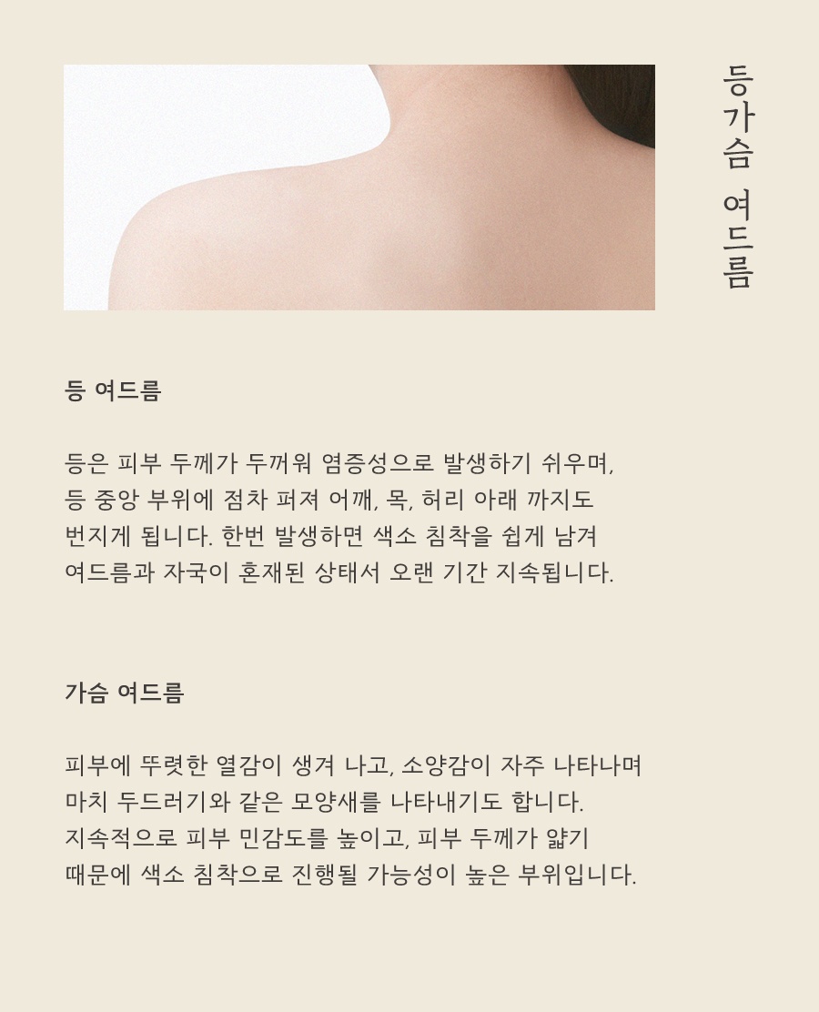 [울산점] 가드름 치료, 가슴 여드름 자국까지 신경 쓰인다면 울산 해율한의원 치료 방법은 - 해율한의원
