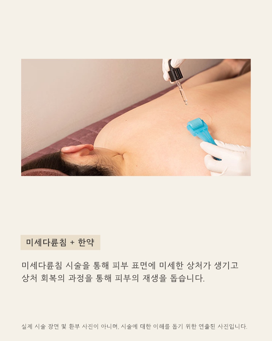 [강남점] 강남가슴여드름 옷에 가려져도 방치하면 안 되는 이유 - 해율한의원