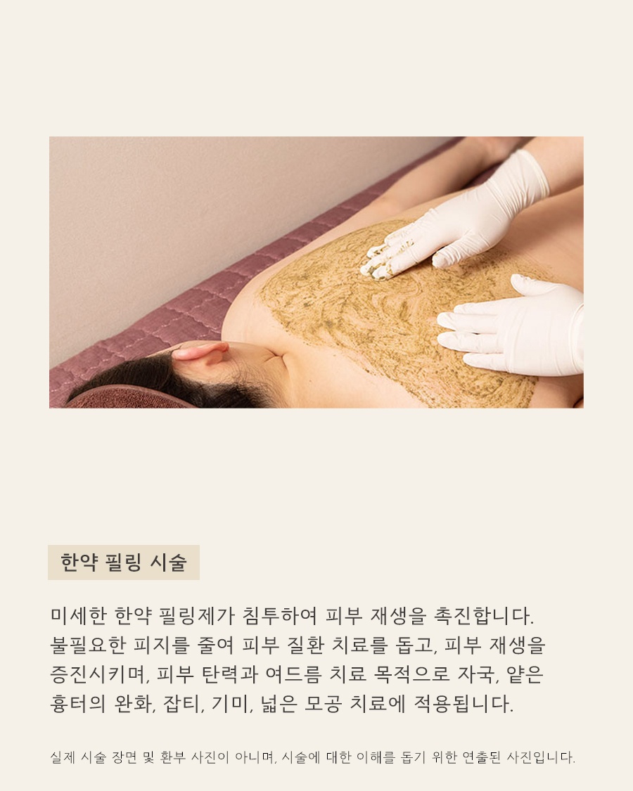 [강남점] 강남가슴여드름 옷에 가려져도 방치하면 안 되는 이유 - 해율한의원