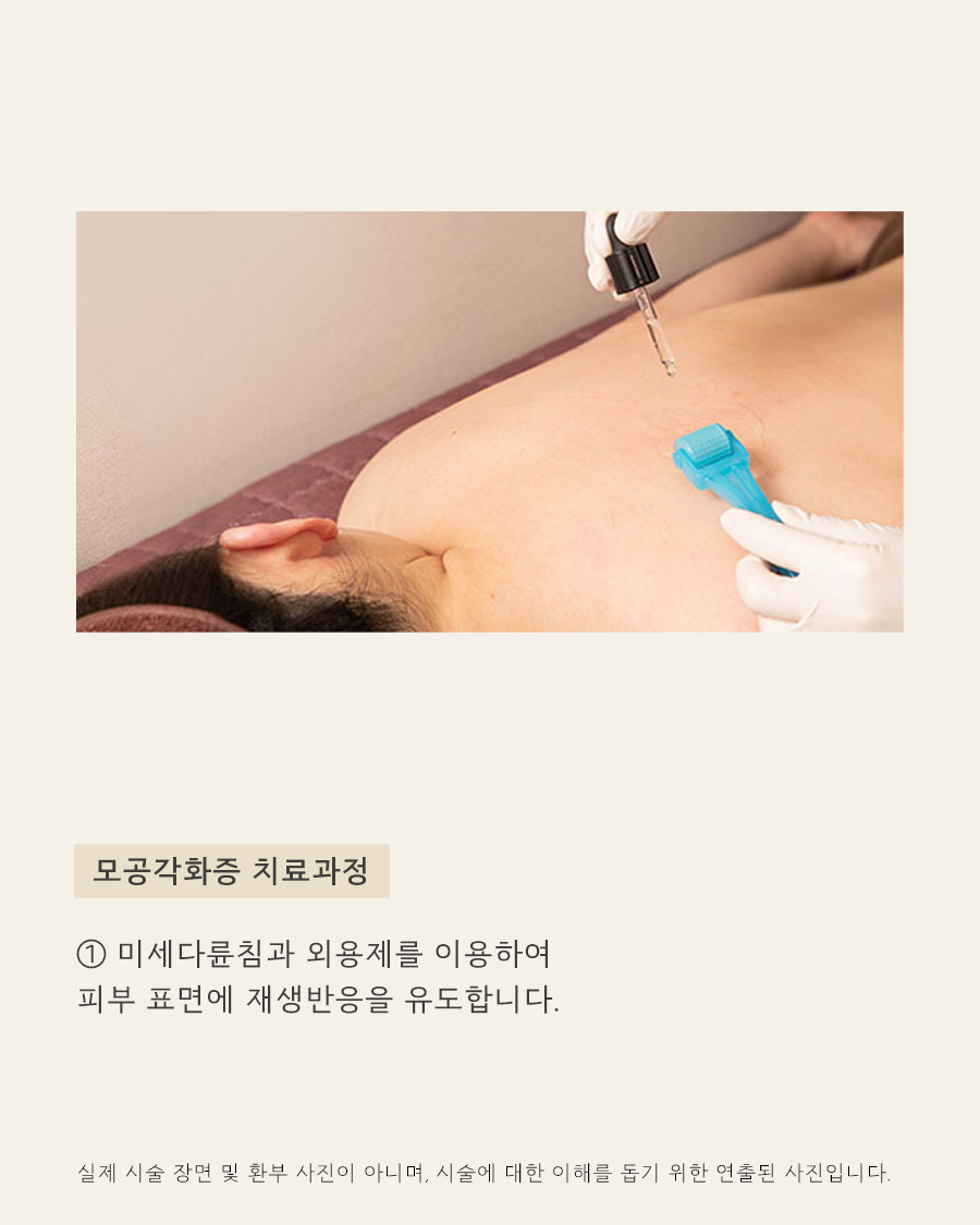 [노원점] 노원모공각화증 닭살과 구분하는 방법 원장님이 설명드립니다 - 해율한의원