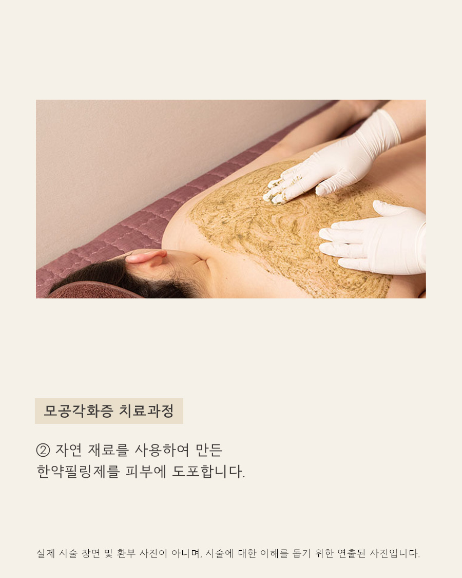 [노원점] 노원모공각화증 닭살과 구분하는 방법 원장님이 설명드립니다 - 해율한의원