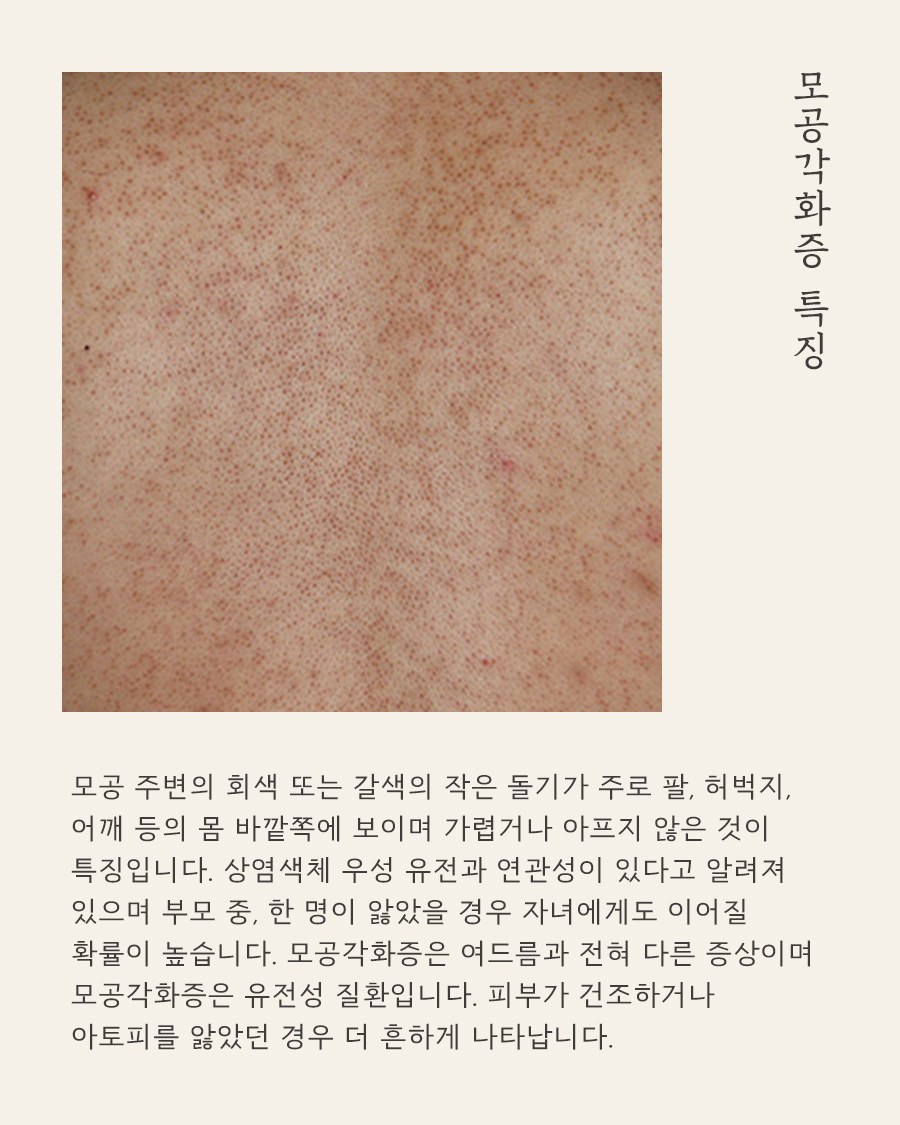 [목동점] 목동모공각화증은 어떻게 치료하나요? - 해율한의원