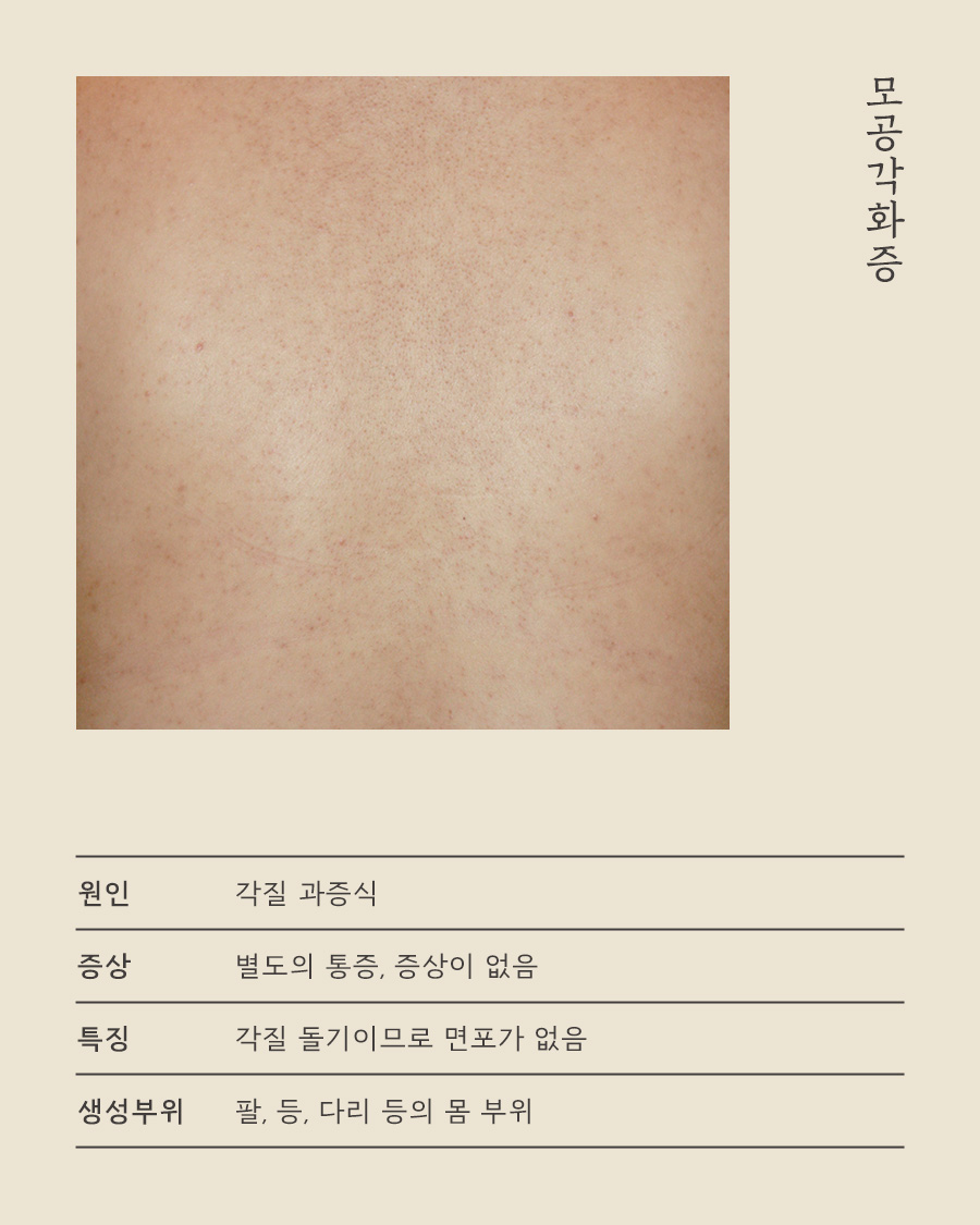 [목동점] 목동모공각화증은 어떻게 치료하나요? - 해율한의원