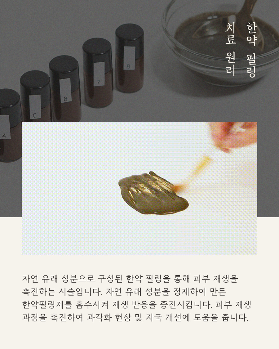 [목동점] 목동모공각화증 치료방법 (율각테라피 원리 및 효과) - 해율한의원
