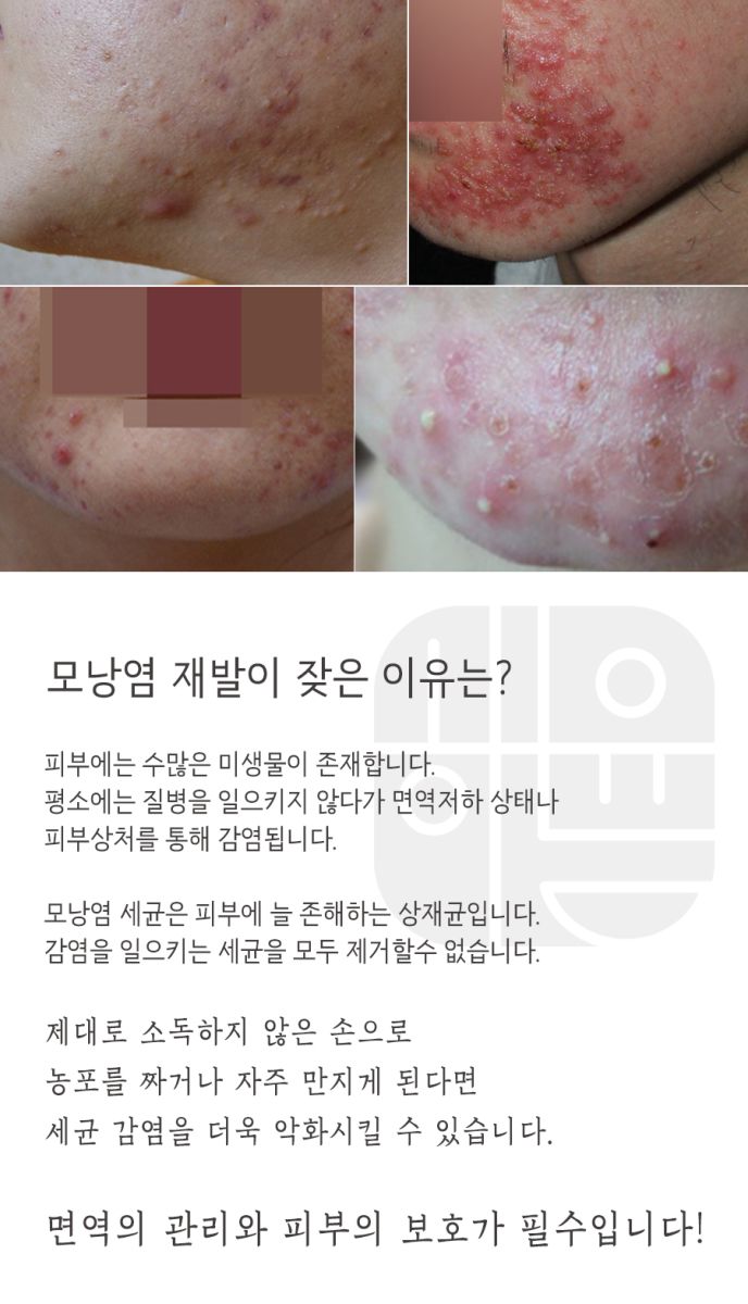 [강남점] 모낭염 압출방법 한약이나 약침 치료를 활용하기도 하나요? 강남 해율한의원에서 설명드립니다 - 해율한의원