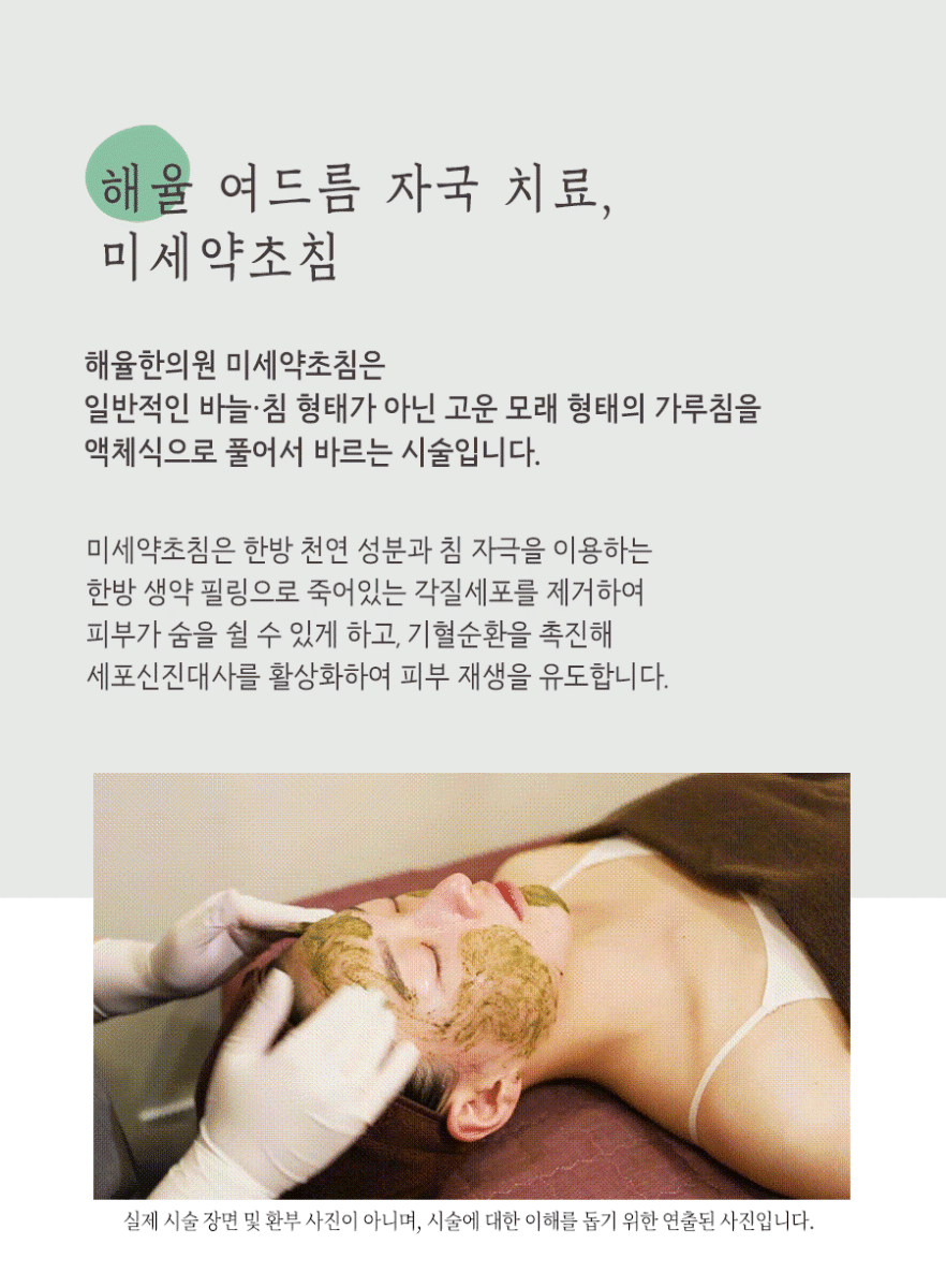 [수원점] 수원여드름자국 미세약초침 치료 후 주의해야 하는 부분은? - 해율한의원