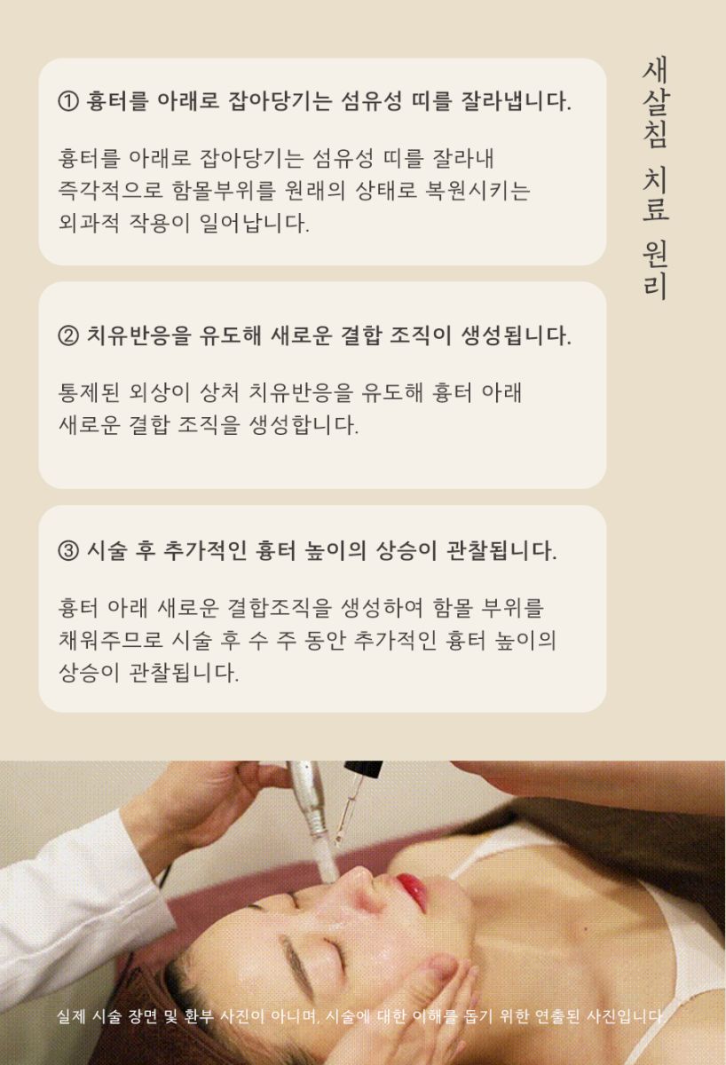 [대구점] 대구패인흉터 수두흉터 자연적으로 없어지지 않는 이유는? - 해율한의원