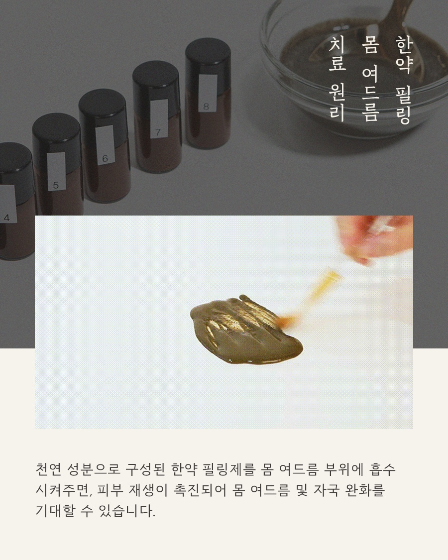 [수원점] 수원등여드름 어느 순간 넓게 번지고 있다면 원인 설명드립니다 - 해율한의원