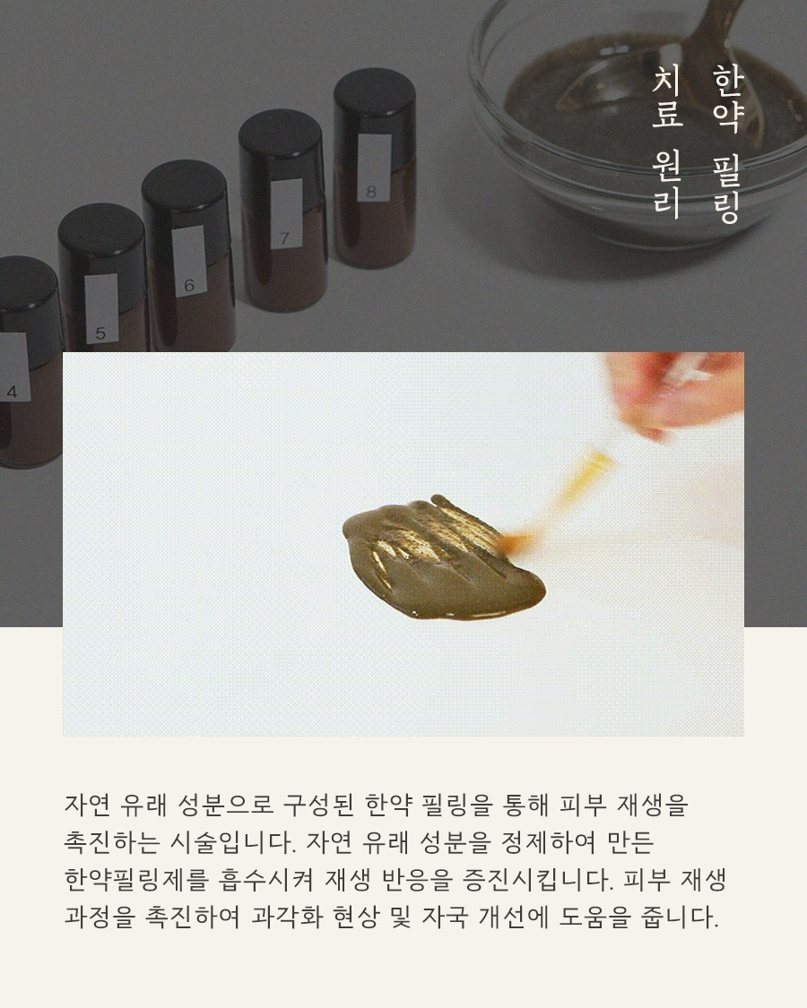 [안양점] 안양모공각화증 자꾸 만져지는 오돌토돌한 피부 고민, 원장님이 설명드립니다 - 해율한의원