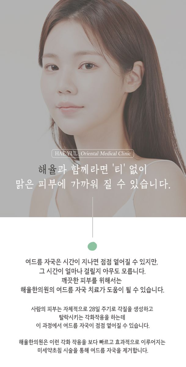 [목동점] 여드름자국 모공 축소 치료는 보통 얼마나 걸리나요? 목동 해율한의원에서 설명드립니다 - 해율한의원
