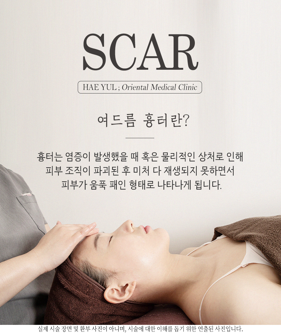 [홍대점] 홍대여드름흉터 어떤 방법으로 치료하나요? - 해율한의원
