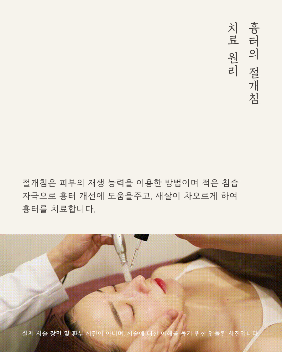 [목동점] 여드름 흉터가 반복되는 내부적·외부적 원인은 무엇인가요? - 해율한의원