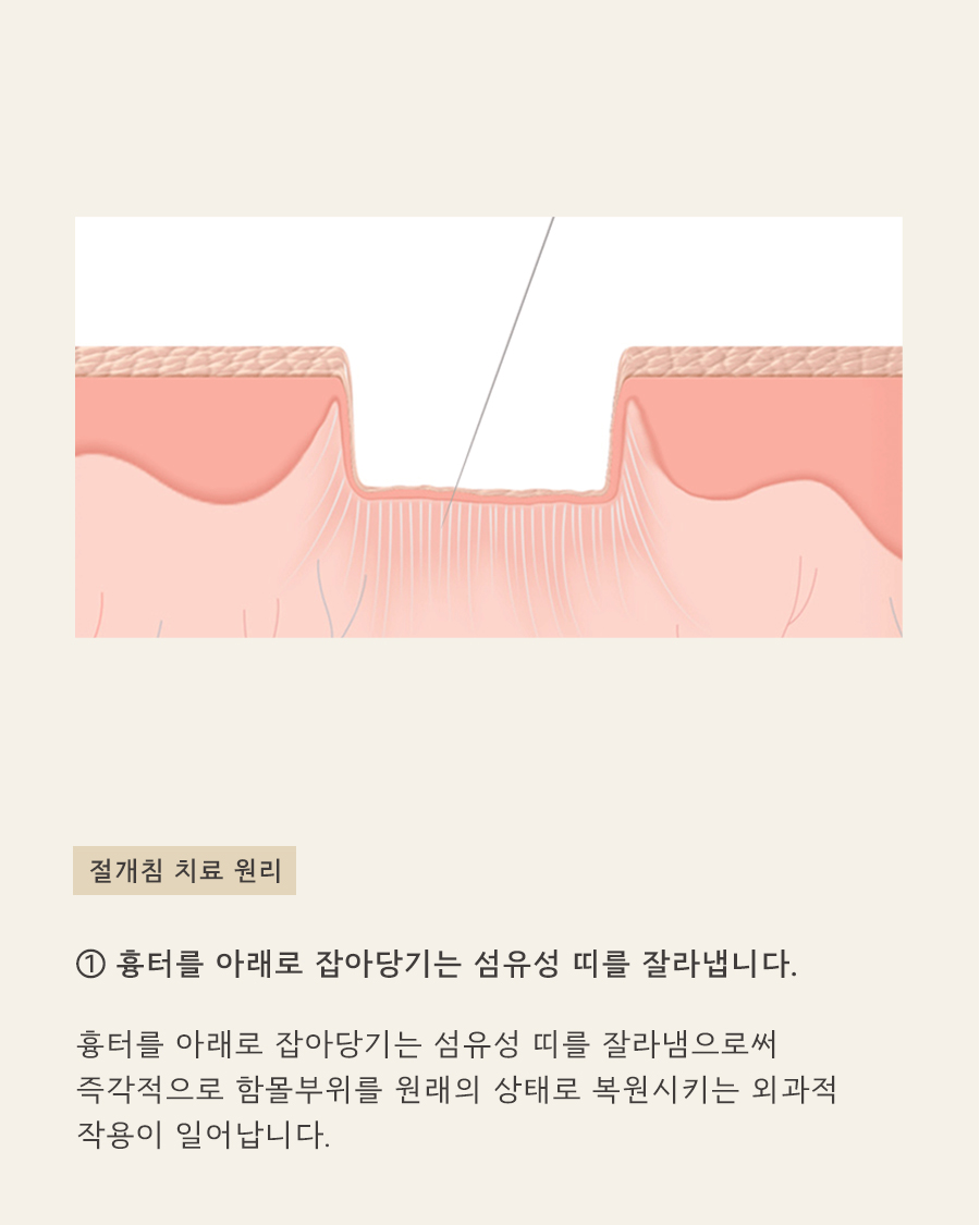 [목동점] 여드름 흉터가 반복되는 내부적·외부적 원인은 무엇인가요? - 해율한의원