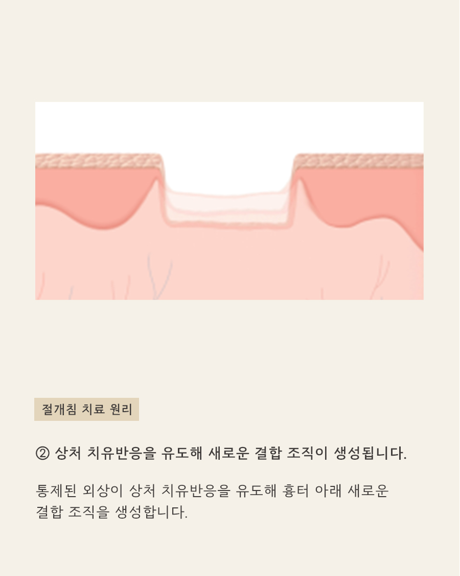[목동점] 화장으로 가려지지 않는 여드름흉터, 어떻게 치료할까요? - 해율한의원