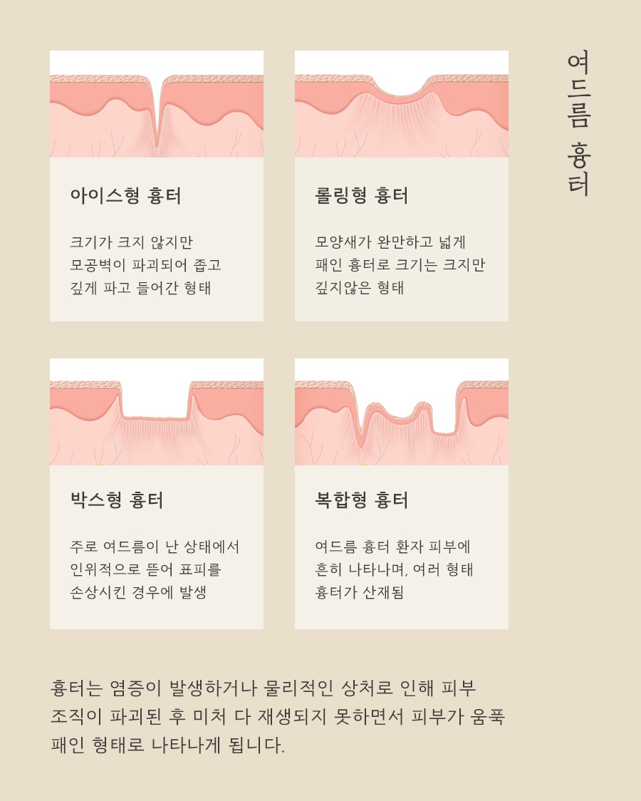 [인천점] 인천여드름한의원 턱선을 따라 트러블이 올라오는 이유는? - 해율한의원
