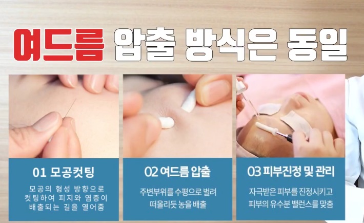 [인천점] 인천피부한의원 좁쌀여드름 방치하면 안되는 이유는? - 해율한의원