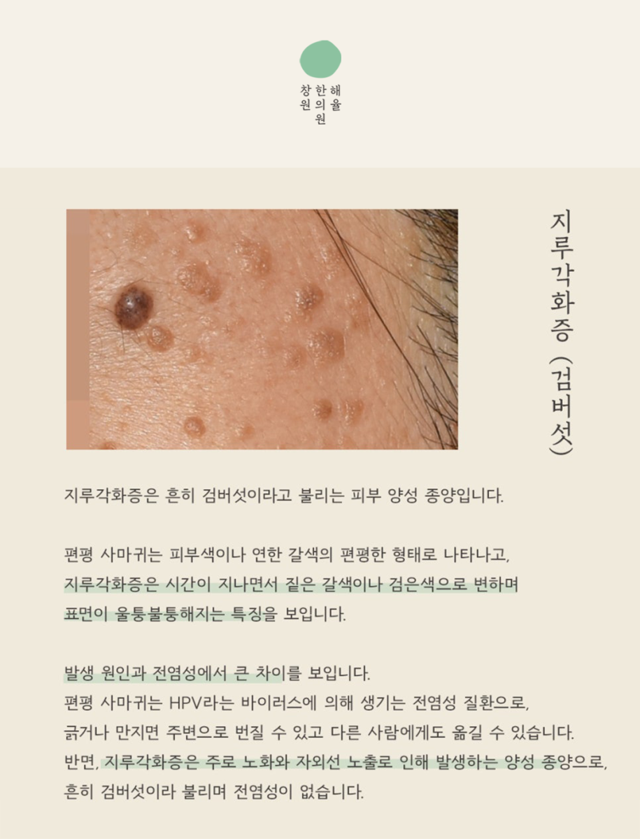 [창원점] 창원편평사마귀 제거 후 딱지와 붉은기는 어떻게 관리할까? - 해율한의원