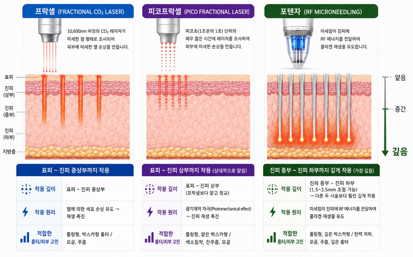 프락셀, 피코프락셀, 포텐자의 작용 차이를 보여주는 그림