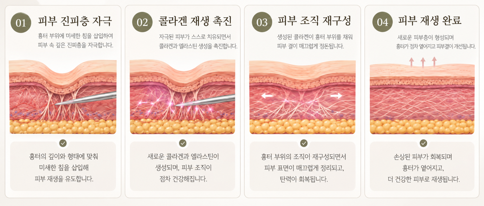 [수원점] 새살침으로 올라온 흉터 다시 꺼지진 않나요? - 해율한의원