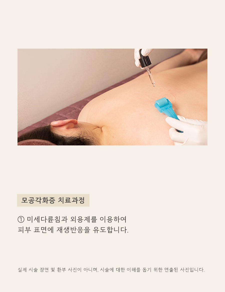 [수원점] 모공각화증 과연 일시적인 현상일까요?수원해율한의원 치료 방법 - 해율한의원