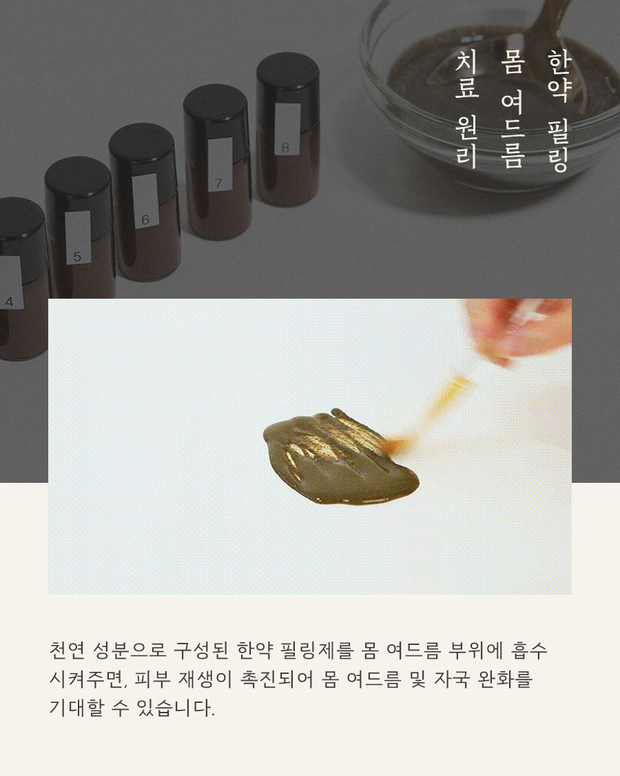 [천안점] 가슴여드름 가드름 색소 침착, 자국 남는 이유는? 천안 해율한의원에서 설명드립니다 - 해율한의원