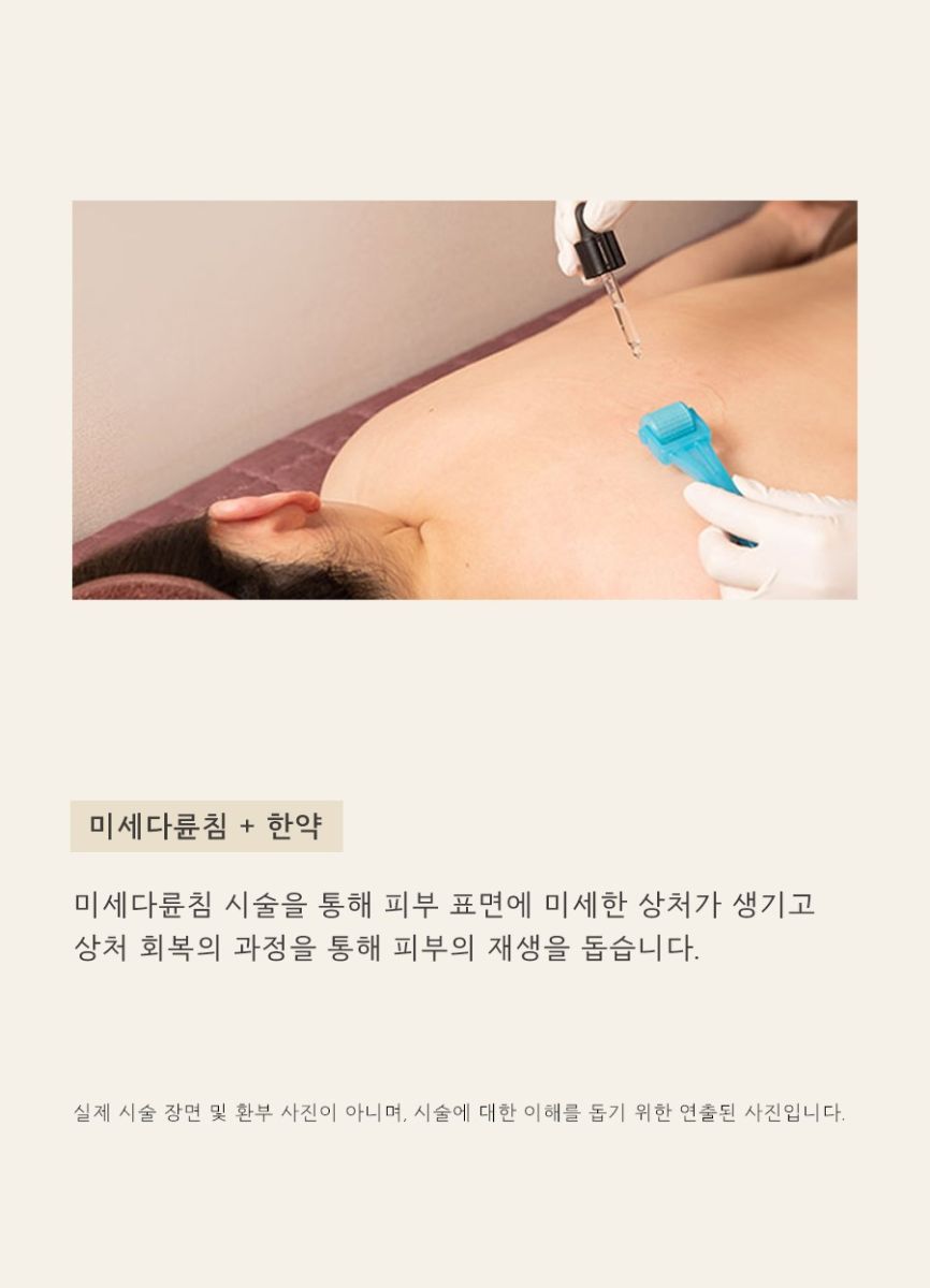 [천안점] 가슴여드름 가드름 색소 침착, 자국 남는 이유는? 천안 해율한의원에서 설명드립니다 - 해율한의원