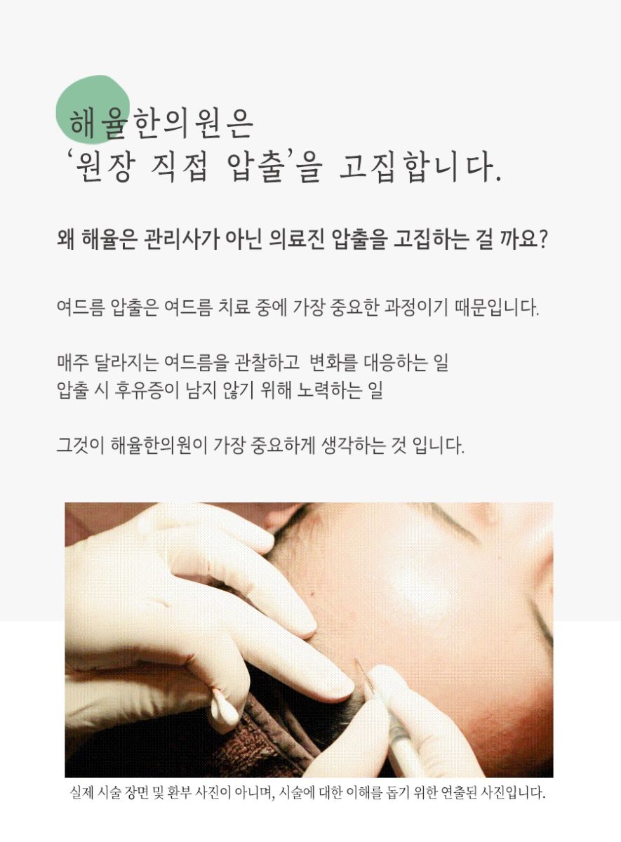 [안산점] 안산여드름한의원 압출 혼자서 하면 안되나요? - 해율한의원