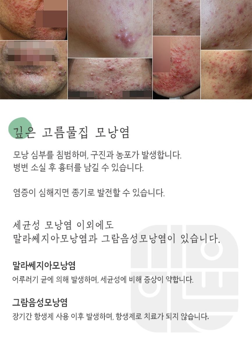 [분당점] 분당모낭염 압출하면 안되는 이유, 원장님이 설명드립니다 - 해율한의원