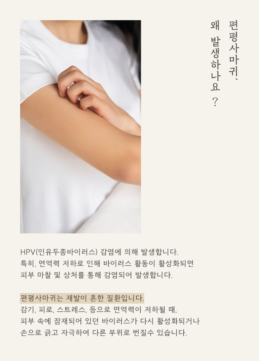 [인천점] 인천편평사마귀 제거 언제 치료하는게 좋을까요? - 해율한의원