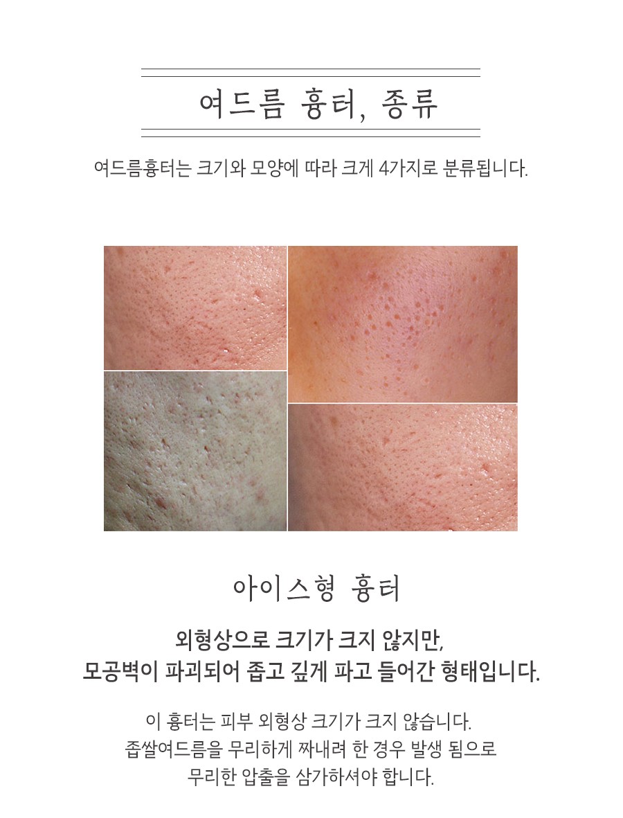 [홍대점] 홍대여드름흉터 어떤 방법으로 치료하나요? - 해율한의원
