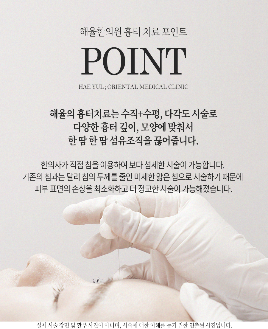 [홍대점] 홍대여드름흉터 오래된 경우에도 치료  가능한가요? - 해율한의원