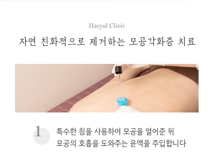 [창원점] 종아리모공각화증과 여드름은 어떻게 다른가요? 창원 해율한의원에서 설명드립니다 - 해율한의원