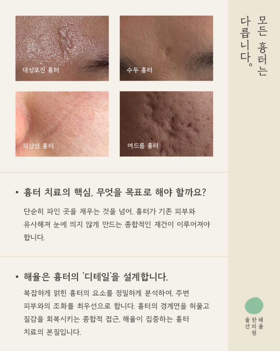 [울산점] 울산해율한의원 여드름흉터, 파인흉터 새살침과 레이저 병행치료법과 비용설명 드립니다. - 해율한의원