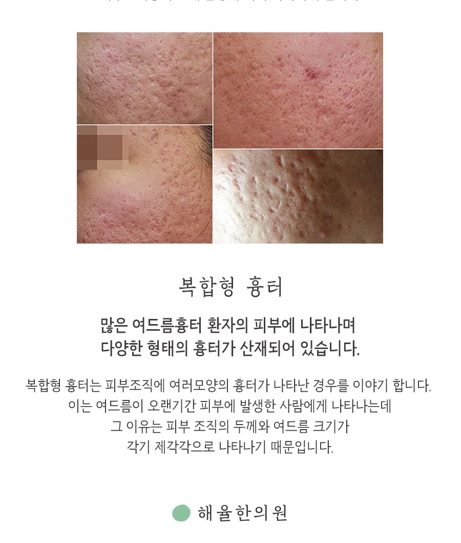 [대구점] 대구새살침 부작용이나 주의사항이 있나요? - 해율한의원