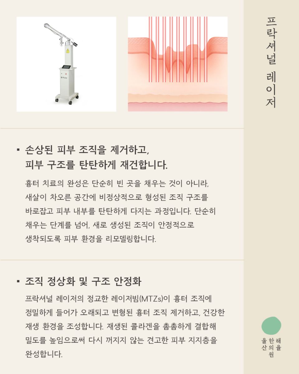[울산점] 울산해율한의원 여드름흉터, 파인흉터 새살침과 레이저 병행치료법과 비용설명 드립니다. - 해율한의원