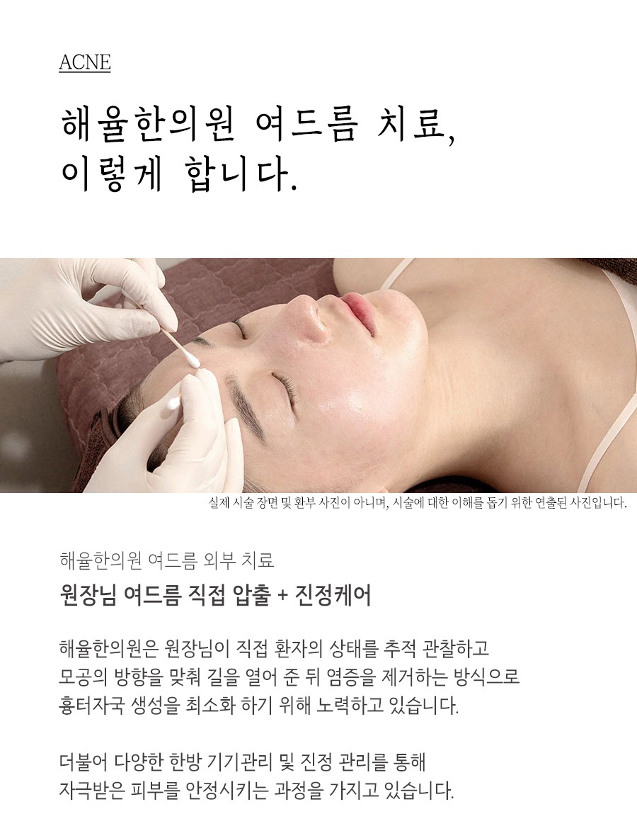[안산점] 안산여드름치료 딱딱하게 만져지는 여드름도 압출할 수 있나요? - 해율한의원