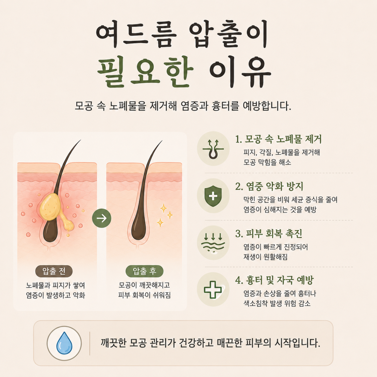 [홍대점] 홍대여드름치료 압출이 필요한 이유, 원장님이 설명드립니다 - 해율한의원