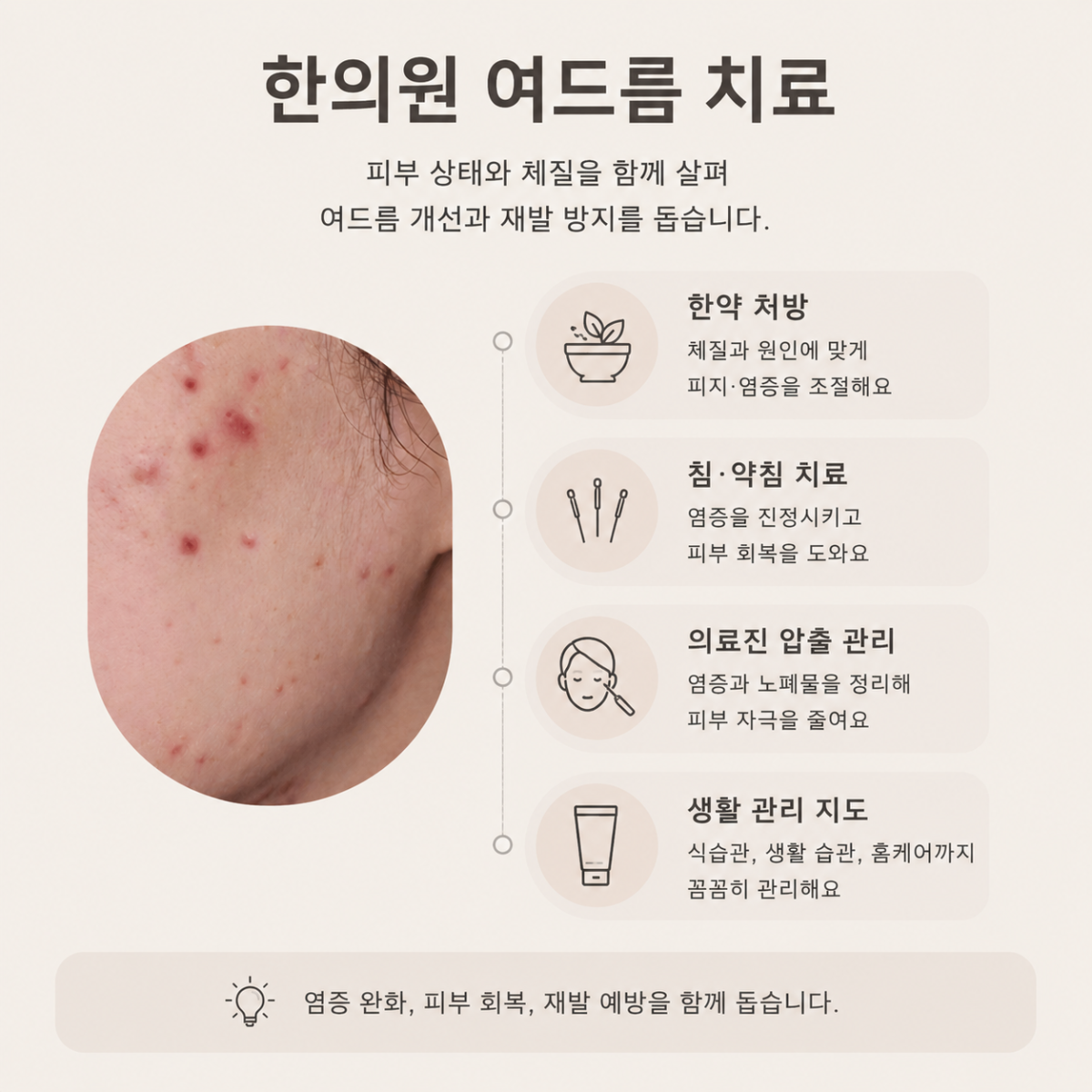 [홍대점] 홍대여드름피부과 화농성 여드름 같은 자리에 반복되는 이유는? - 해율한의원