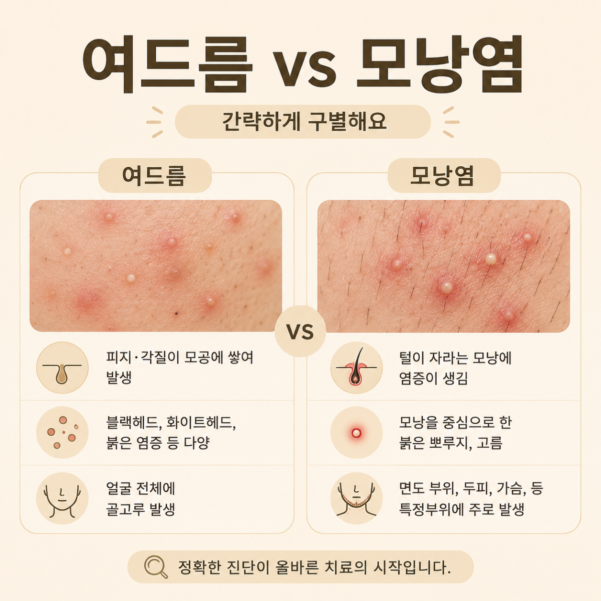[목동점] 목동모낭염 재발한다면 확인해야 할 것들 - 해율한의원