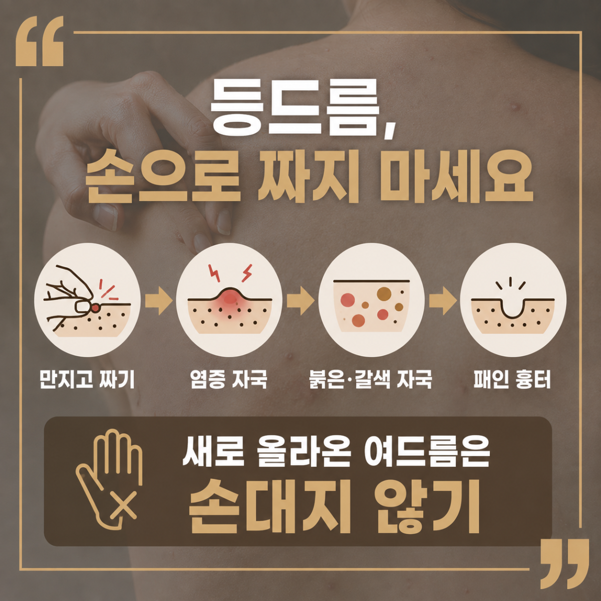 [울산점] 울산등여드름 갑자기 늘었다면 확인해볼 것들 - 해율한의원